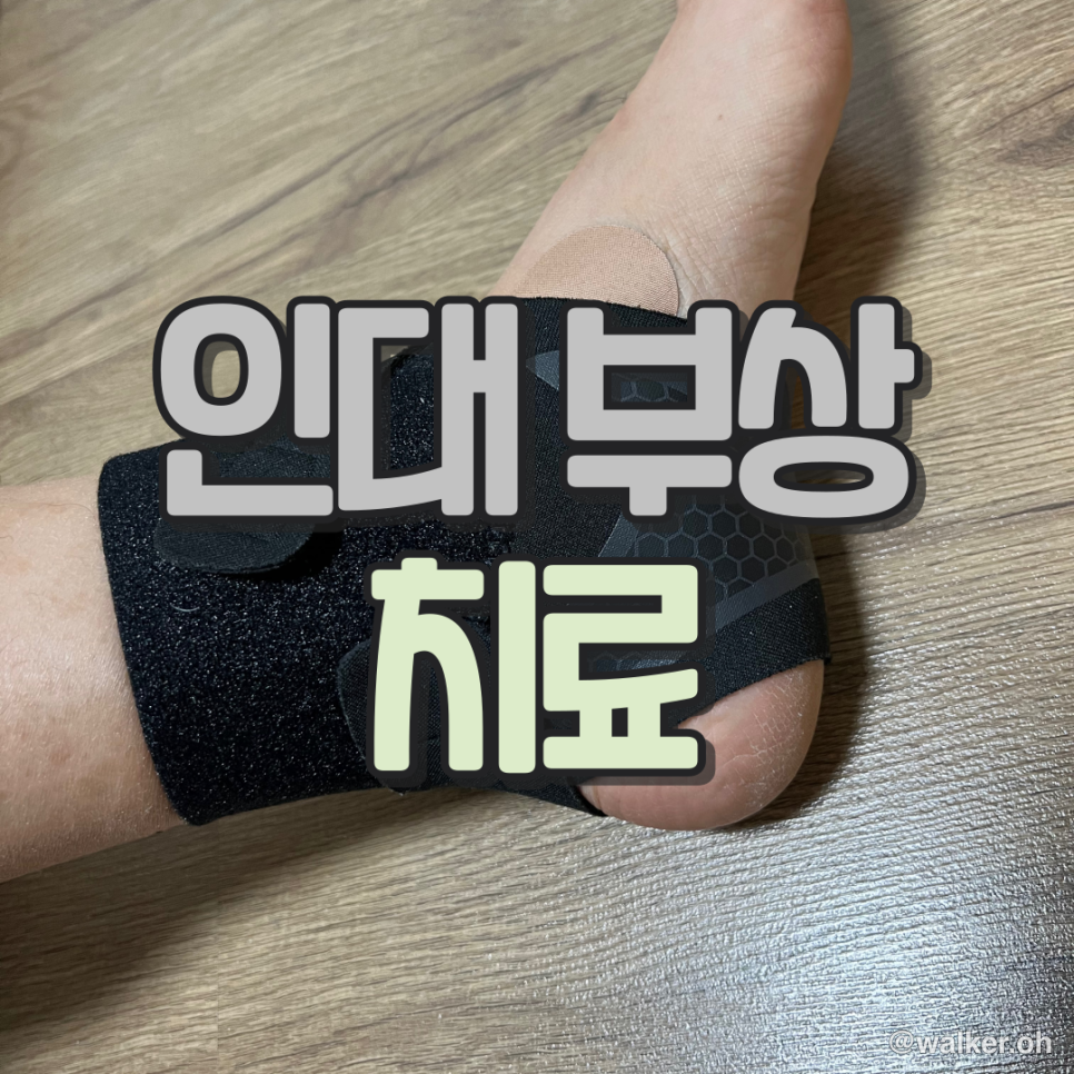 등산 러닝 인대부상 치료 파스효과